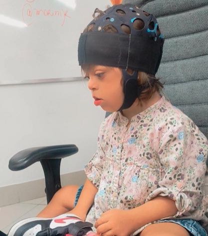 Atendimento infantil com neuromodulação tDCS